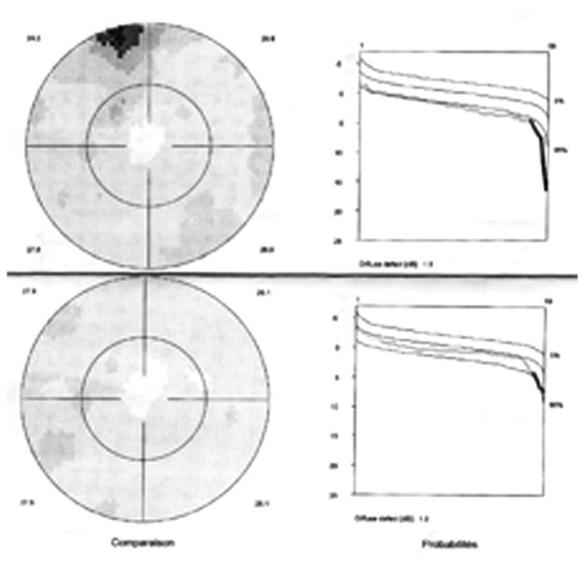 Figure 4B