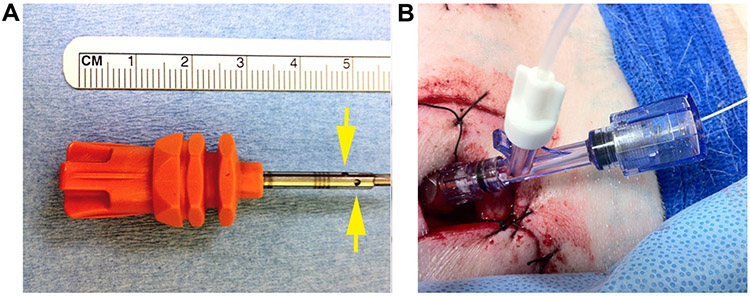 Figure 1: