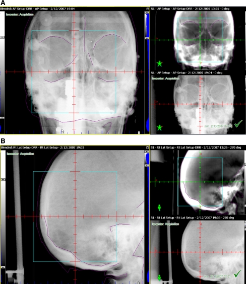 Fig. 3