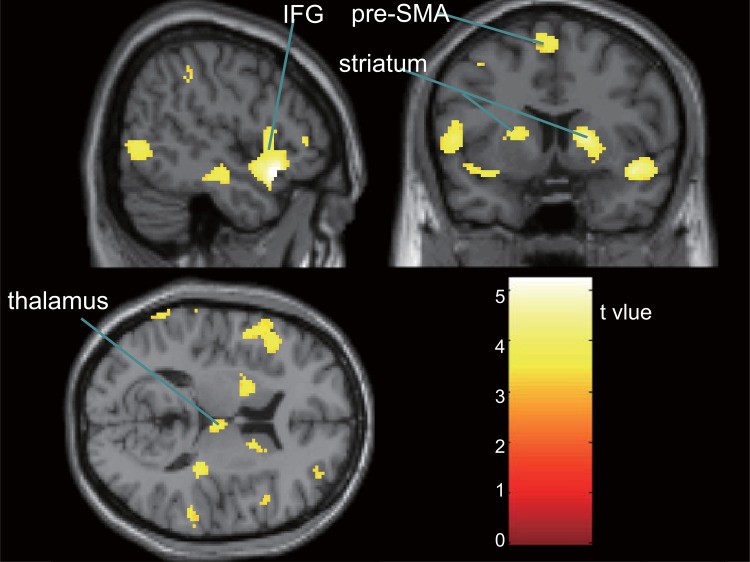 Fig 1