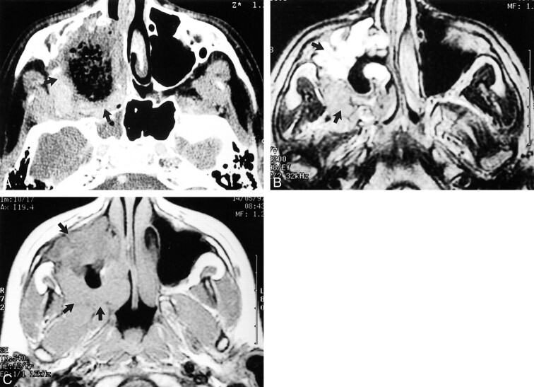 fig 5.