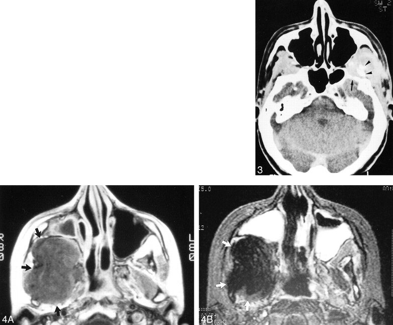 fig 3.