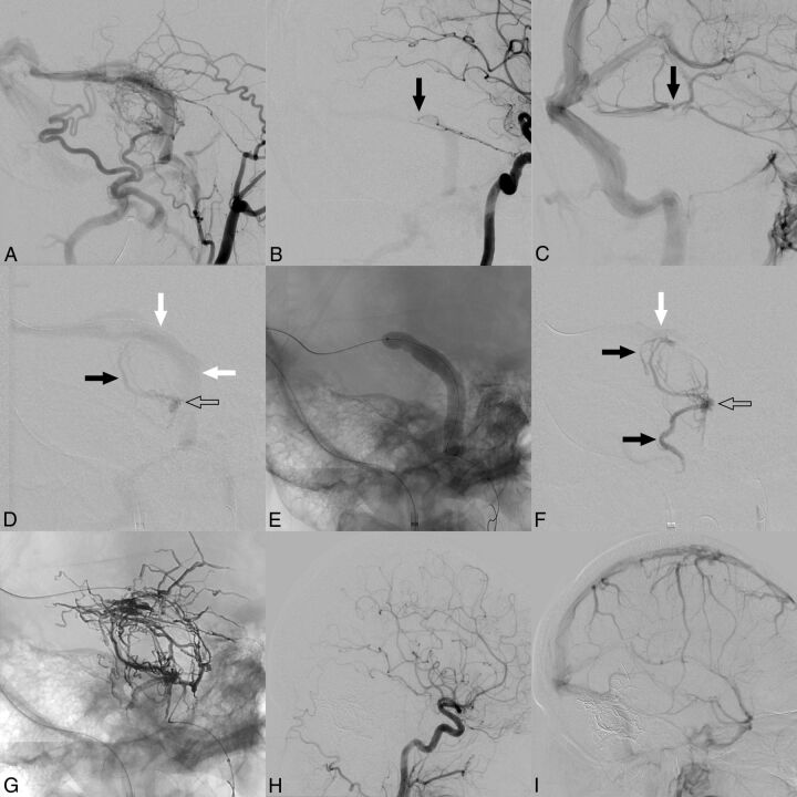 Fig 2.