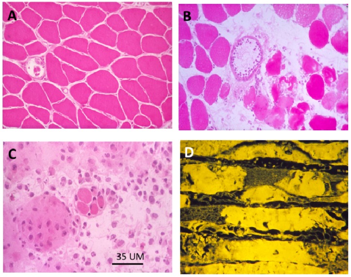 Figure 18