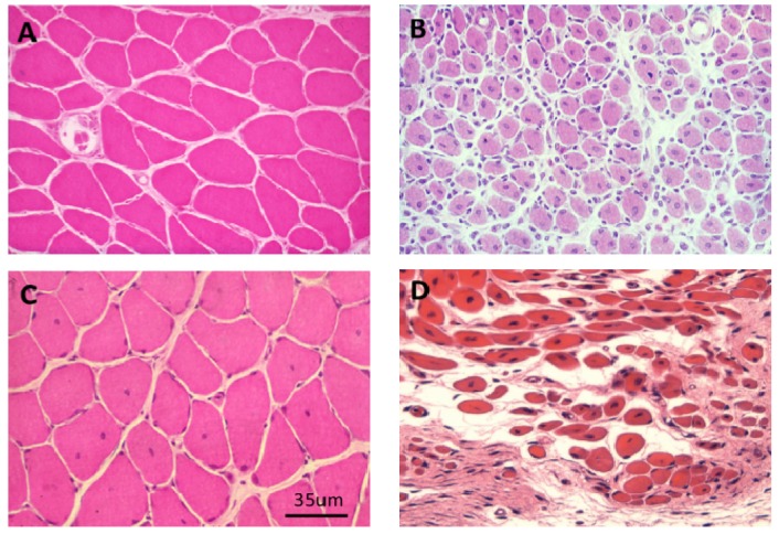 Figure 21