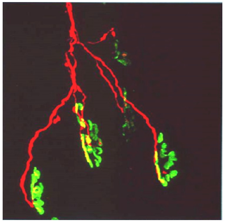 Figure 17