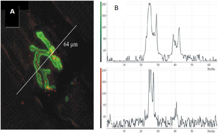 Figure 14