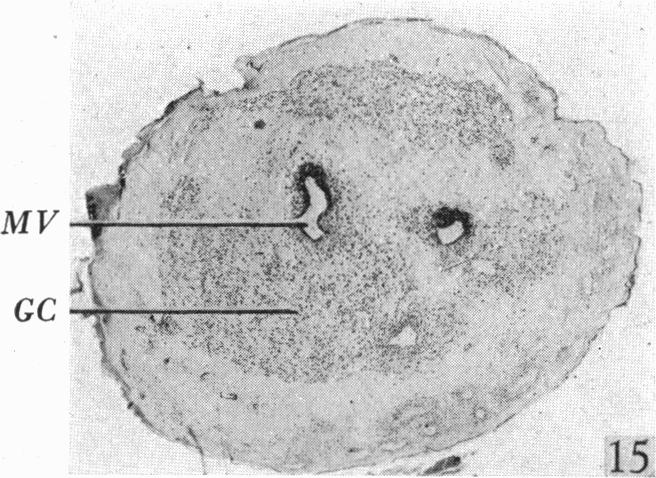 Fig. 15