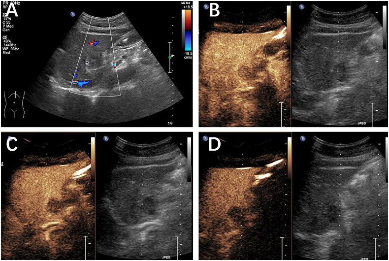 Figure 4.