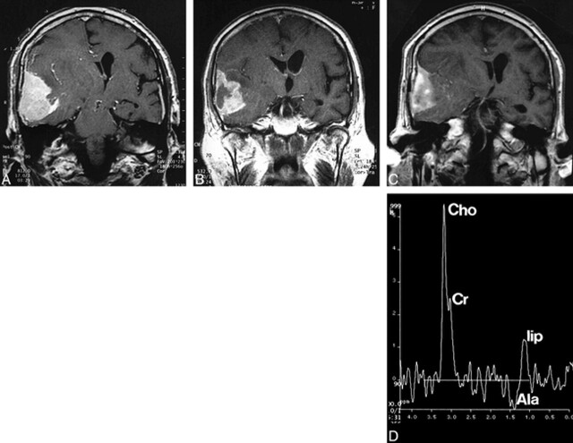 fig 3.