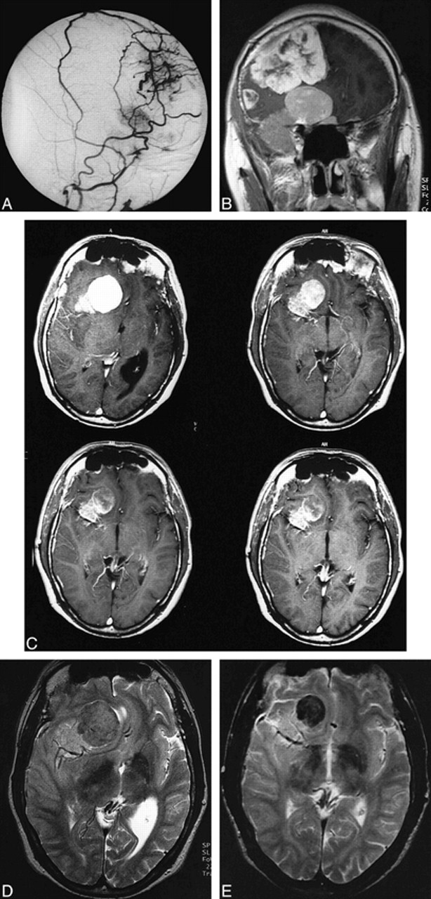 fig 1.