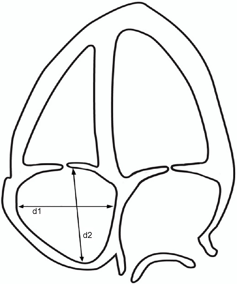 Figure 12