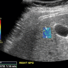 Figure 7a.