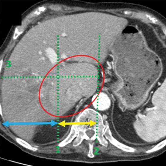 Figure 1b.