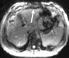 Figure 13g.