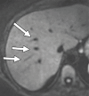 Figure 14c.