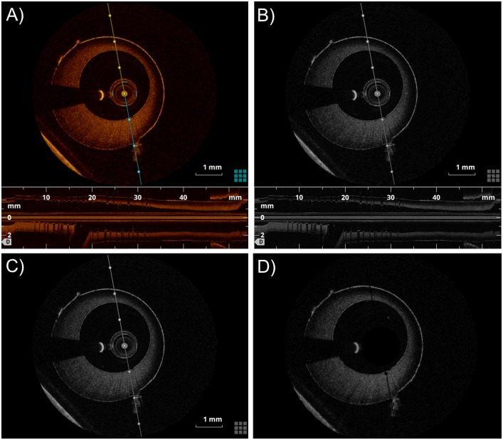 Fig 2