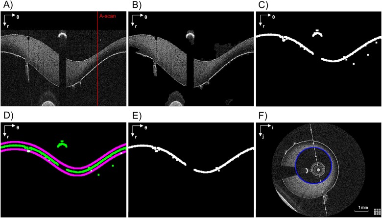 Fig 3