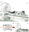 Figure 1 -