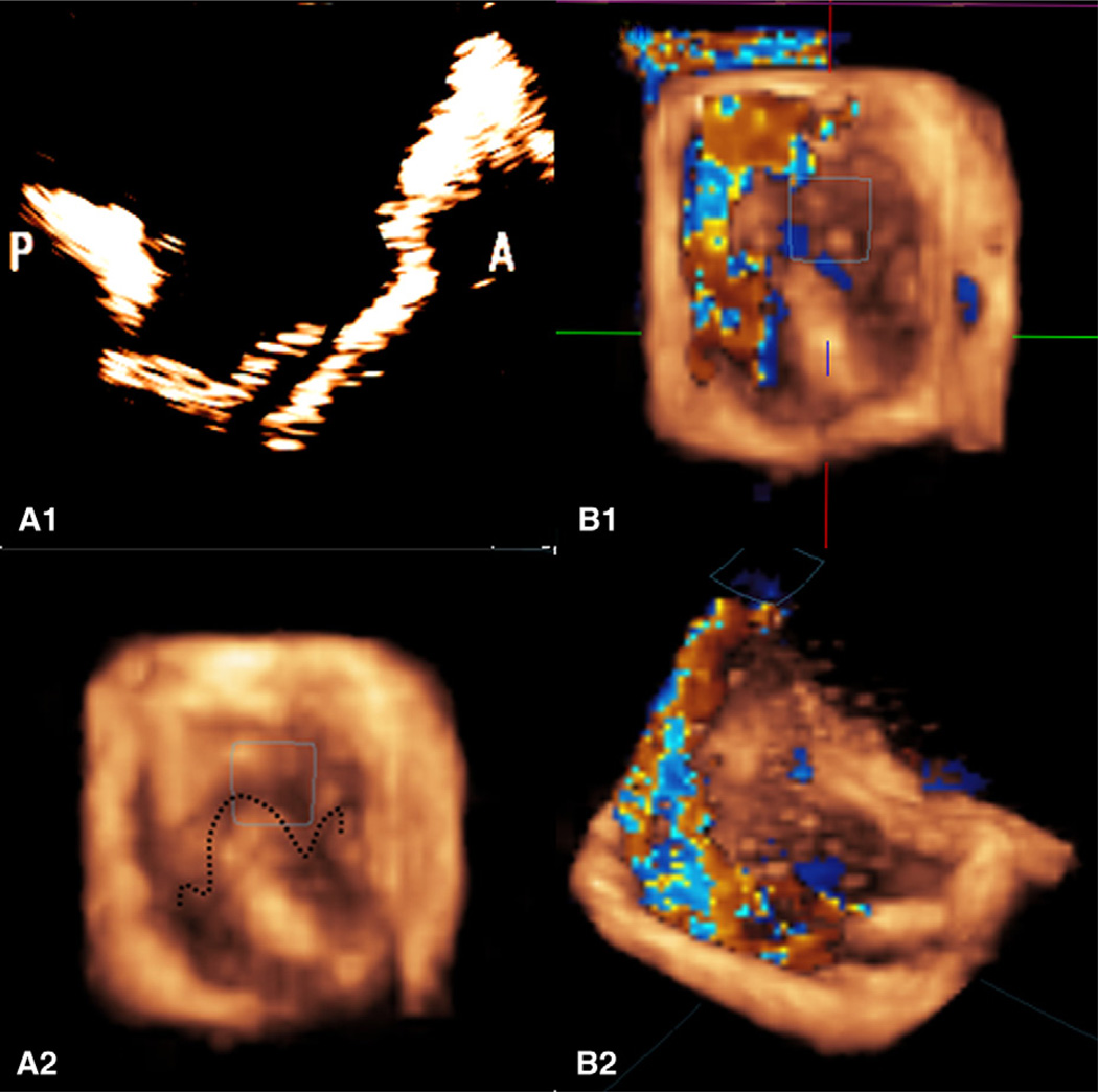 FIGURE 2