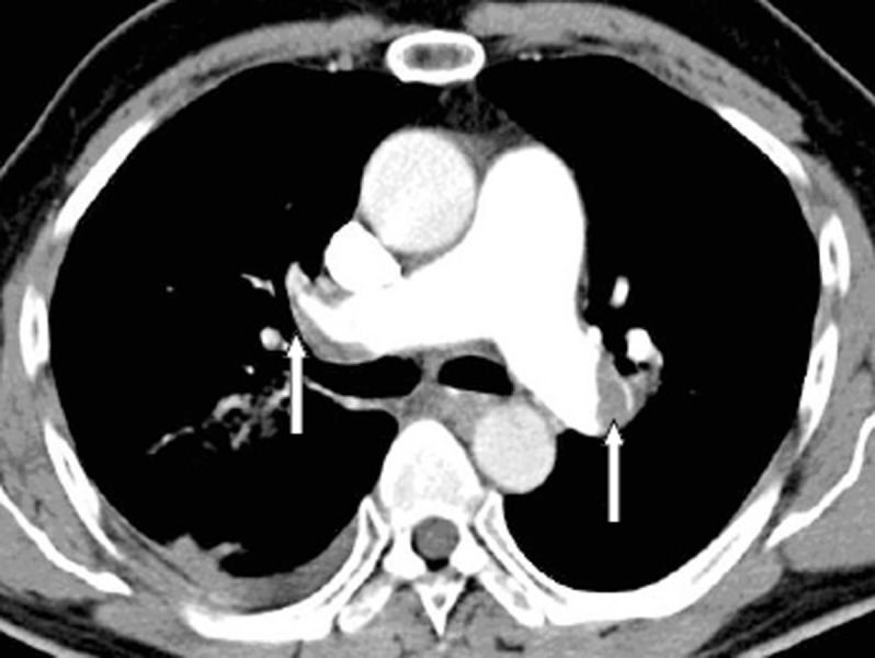 Figure 1a