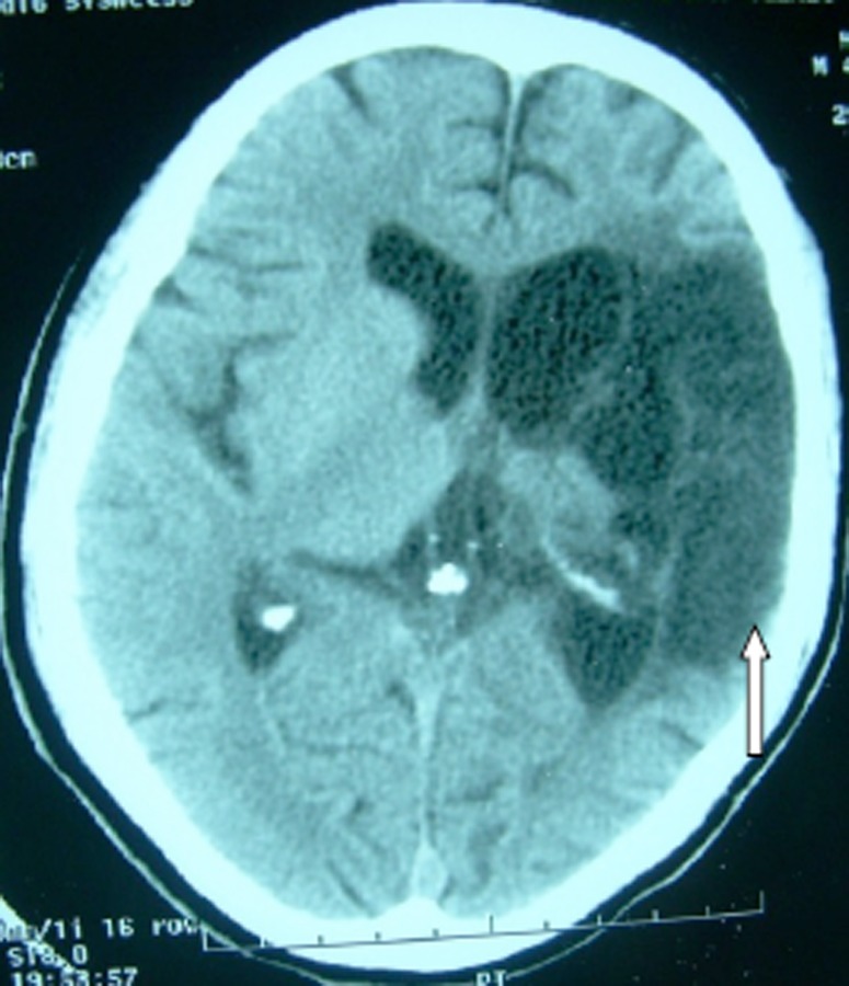 Figure 2a