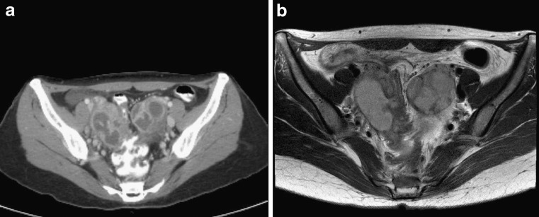 Fig. 1a, b