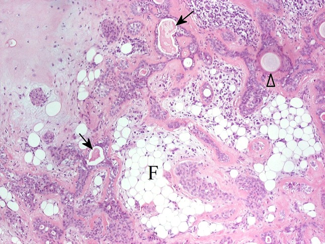 Fig. 22