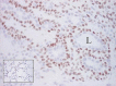 Fig. 17