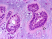 Fig. 12