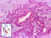 Fig. 15