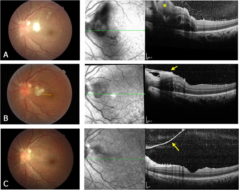 Fig. 3