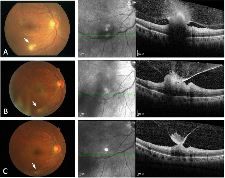 Fig. 2