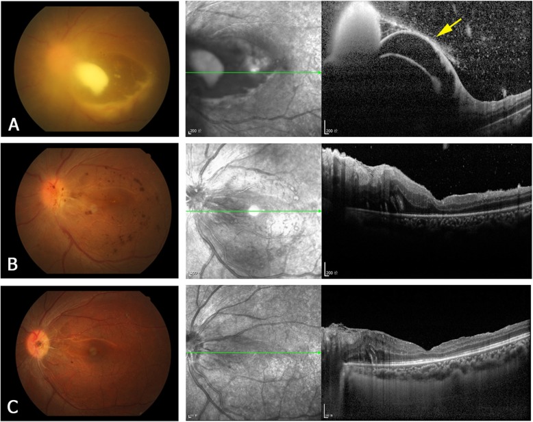 Fig. 4