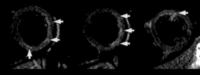 Fig. 31