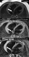 Fig. 20