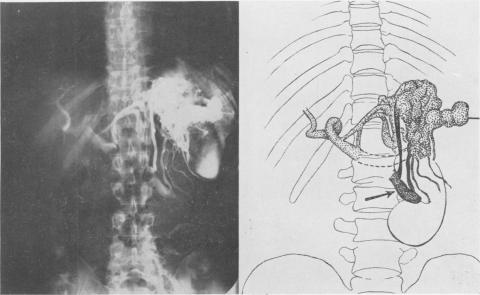 Fig. 8B.