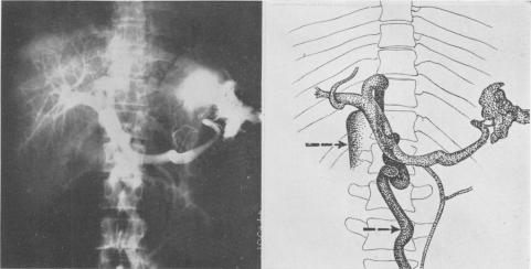 Fig. 9C.