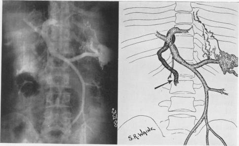 Fig. 9F.