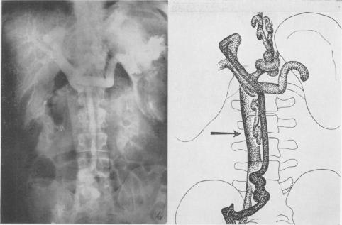 Fig. 9A.