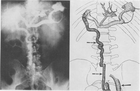 Fig. 9B.