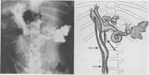 Fig. 9D.