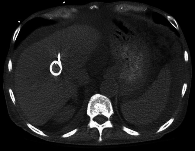 Fig. 1.