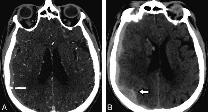 Fig 2.