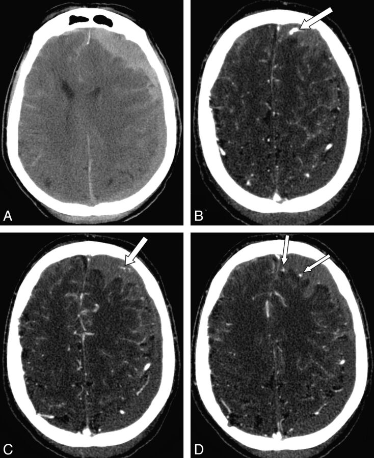 Fig 3.