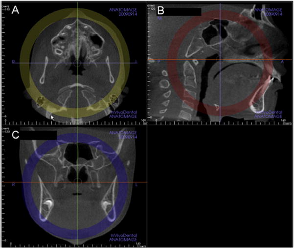 Fig 1