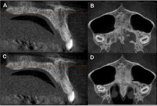 Fig 10