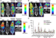 Figure 4. [18F]-FDG imaging and biodistribution in subcutaneous MM.1S, RPMI8226, and ANBL6 xenograft models. MIP and CT and μPET/CT fusion images of [18F]-FDG (coronal and transverse posture) in (A) MM.1S (n = 5), (B) RPMI8226 (n = 5), and (C) ANBL6 (n = 5) subcutaneous xenografts at 1 hour after injection. D, Biodistribution of [18F]-FDG in MM.1S, RPMI8226, and ANBL6 subcutaneous xenografts after μPET/CT imaging at 1 hour after injection.
