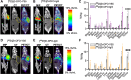 Figure 3. [89Zr]Zr-DFO-YS5 imaging and biodistribution in RPMI8226 and ANBL6 subcutaneous xenograft models. MIP and CT and μPET/CT fusion images of (A) [89Zr]Zr-DFO-YS5 (n = 4) and (B) [89Zr]Zr-DFO-IgG (n = 5) in NSG mice bearing subcutaneous RPMI8226 xenografts at 6 days after injection. C, Biodistribution of [89Zr]Zr-DFO-YS5 and [89Zr]Zr-DFO-IgG in NSG mice bearing subcutaneous RPMI8226 xenografts at 6 days after injection. MIP and CT and μPET/CT fusion images of (D) [89Zr]Zr-DFO-YS5 (n = 4) and (E) [89Zr]Zr-DFO-IgG (n = 5) in NSG mice bearing subcutaneous ANBL6 xenografts at 6 days after injection. F, Biodistribution of [89Zr]Zr-DFO-YS5 and [89Zr]Zr-DFO-IgG in NSG mice bearing subcutaneous ANBL6 xenografts at 6 days after injection. Two-way ANOVA P values are indicated as *, P < 0.05; **, P < 0.01; ***, P < 0.001; ****, P < 0.0001.