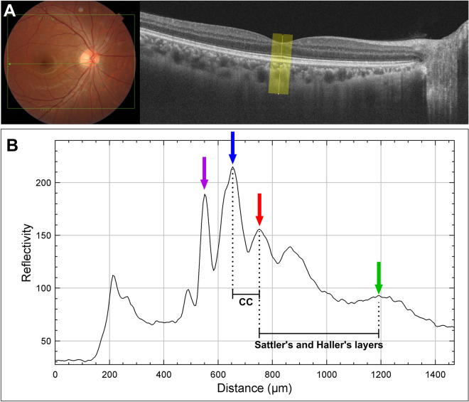 Fig. 1